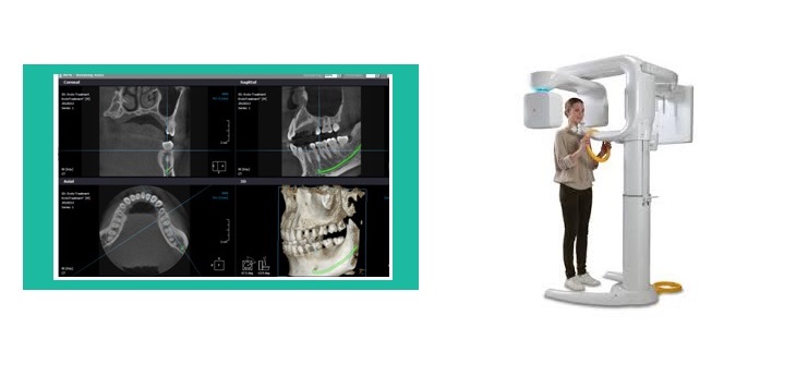 Esami CBCT Tomografo Cone Beam 3D, videocorso per software referti